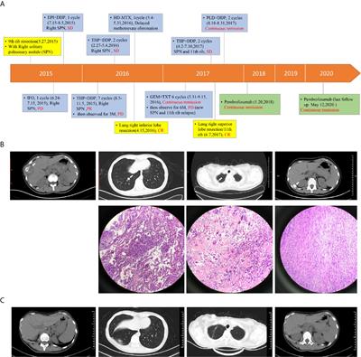 Case Report: Sequential Chemotherapy and Immunotherapy Produce Sustained Response in Osteosarcoma With High Tumor Mutational Burden